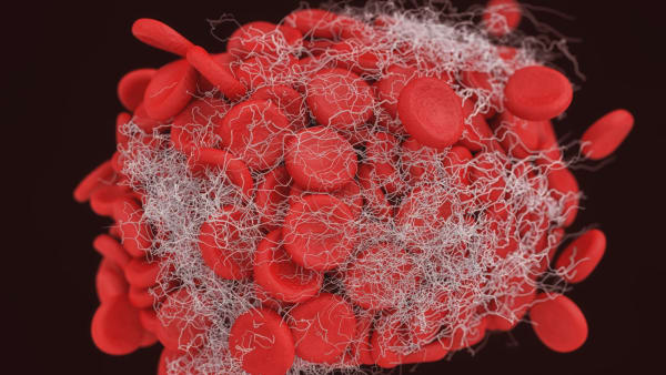 ADAMTS13 Antibodies in Thrombotic Thrombocytopenic Purpura