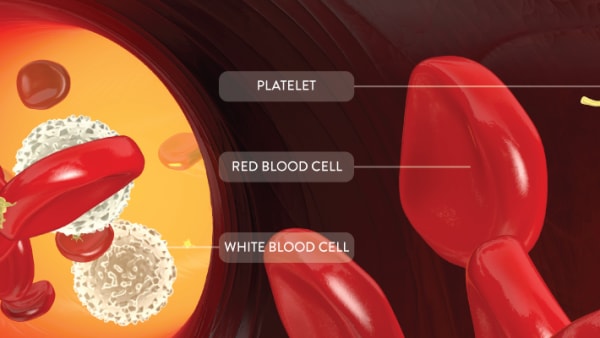 Blood disorders - overview